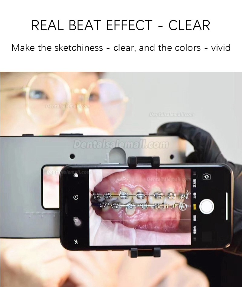 Mobile Dental Photography Filling Light Dentist Oral LED Fill Light Photography Flashlight
